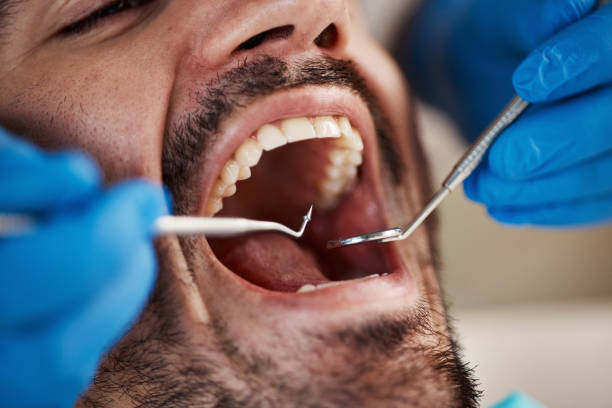 Best Root Canal Treatment  in Bogata, TX